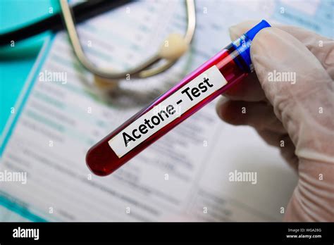 acetone paint test|acetone in blood test.